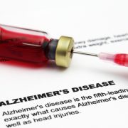 ricerca Alzheimer